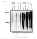 Fig. 03 - ABNORMAL PROTEIN REMOVING METHOD
