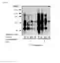 Fig. 04 - ABNORMAL PROTEIN REMOVING METHOD