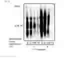 Fig. 05 - ABNORMAL PROTEIN REMOVING METHOD