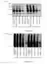Fig. 06 - ABNORMAL PROTEIN REMOVING METHOD