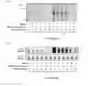 Fig. 07 - ABNORMAL PROTEIN REMOVING METHOD