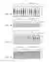 Fig. 02 - Compositions and methods for inhibiting optic nerve damage