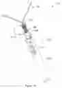 Fig. 02 - APPARATUS AND METHODS FOR MODULATING THE SIZE OF AN IMPLANTABLE SLING