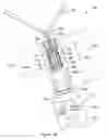 Fig. 03 - APPARATUS AND METHODS FOR MODULATING THE SIZE OF AN IMPLANTABLE SLING