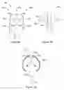 Fig. 05 - APPARATUS AND METHODS FOR MODULATING THE SIZE OF AN IMPLANTABLE SLING