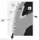 Fig. 01 -  BOLSTER FOR SECURING A SEPTAL SPLINT TO A CARDIAC WALL, A METHOD OF USE THEREOF, AND A SYSTEM INCLUDING THE SAME