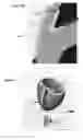 Fig. 05 -  BOLSTER FOR SECURING A SEPTAL SPLINT TO A CARDIAC WALL, A METHOD OF USE THEREOF, AND A SYSTEM INCLUDING THE SAME