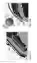 Fig. 09 -  BOLSTER FOR SECURING A SEPTAL SPLINT TO A CARDIAC WALL, A METHOD OF USE THEREOF, AND A SYSTEM INCLUDING THE SAME