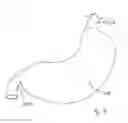 Fig. 06 - Gastric Constriction Device