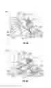 Fig. 07 - SYSTEMS AND METHODS FOR TRANSNASAL DILATION OF PASSAGEWAYS IN THE EAR, NOSE OR THROAT