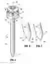 Fig. 03 - Optical trocar with scope holding assembly