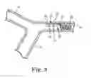 Fig. 04 - Vascular pressure sensor with electrocardiogram electrodes