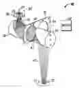Fig. 01 - METHOD FOR NON-INVASIVE ANALYSIS OF A SUBSTANCE CONCENTRATION WITHIN A BODY