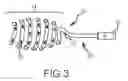Fig. 03 - Apparatus and methods for contactless electrophysiology studies