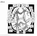 Fig. 05 - Apparatus and method for white-matter-enhancement processing