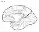 Fig. 07 - Apparatus and method for white-matter-enhancement processing