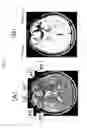 Fig. 16 - Apparatus and method for white-matter-enhancement processing