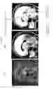 Fig. 23 - Apparatus and method for white-matter-enhancement processing