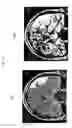 Fig. 26 - Apparatus and method for white-matter-enhancement processing