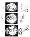 Fig. 28 - Apparatus and method for white-matter-enhancement processing
