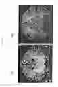 Fig. 29 - Apparatus and method for white-matter-enhancement processing