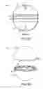 Fig. 08 - Bioabsorbable target for diagnostic or therapeutic procedure