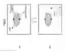 Fig. 03 - Ultrasonic elastography for cross sectional tissue measurement method and apparatus