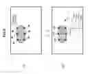 Fig. 07 - Ultrasonic elastography for cross sectional tissue measurement method and apparatus