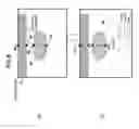 Fig. 09 - Ultrasonic elastography for cross sectional tissue measurement method and apparatus