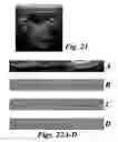 Fig. 20 - System and method to identify and measure organ wall boundaries
