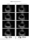 Fig. 31 - System and method to identify and measure organ wall boundaries