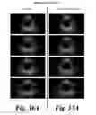 Fig. 33 - System and method to identify and measure organ wall boundaries