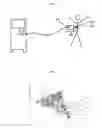 Fig. 02 - DEVICE AND METHOD FOR MICRO-ELASTOGRAPHY