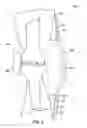 Fig. 05 - Orthotic brace