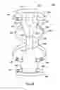 Fig. 26 - Orthotic brace