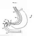 Fig. 16 - Systems and Methods for Treating of Obesity and Type 2 Diabetes