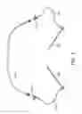 Fig. 09 - System and methods for controlling retrograde carotid arterial blood flow
