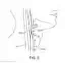 Fig. 11 - System and methods for controlling retrograde carotid arterial blood flow