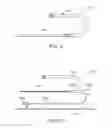 Fig. 14 - System and methods for controlling retrograde carotid arterial blood flow