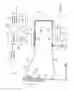Fig. 15 - System and methods for controlling retrograde carotid arterial blood flow
