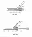 Fig. 22 - System and methods for controlling retrograde carotid arterial blood flow