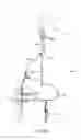 Fig. 24 - System and methods for controlling retrograde carotid arterial blood flow