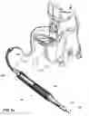 Fig. 03 - Phacoemulsification hook tip