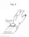 Fig. 05 - Transdermal delivery using encapsulated agent released by ultrasound and/or heat