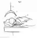 Fig. 03 - Treatment or Therapy Apparatus