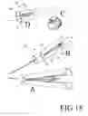 Fig. 16 - Steerable tube