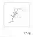 Fig. 20 - Steerable tube