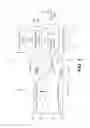 Fig. 04 - Device for increasing cerebral blood flow