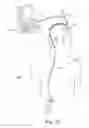 Fig. 13 - System and method for intraparenchymal drug infusion