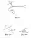 Fig. 15 - System and method for intraparenchymal drug infusion